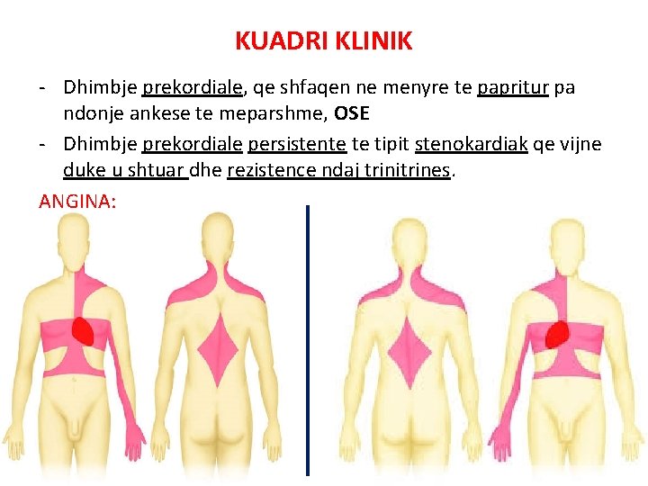 KUADRI KLINIK - Dhimbje prekordiale, qe shfaqen ne menyre te papritur pa ndonje ankese
