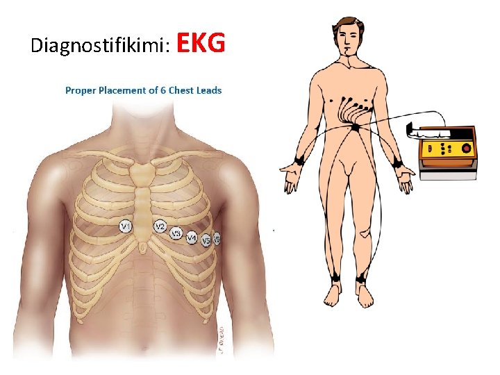 Diagnostifikimi: EKG 