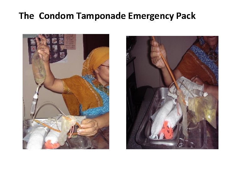 The Condom Tamponade Emergency Pack 