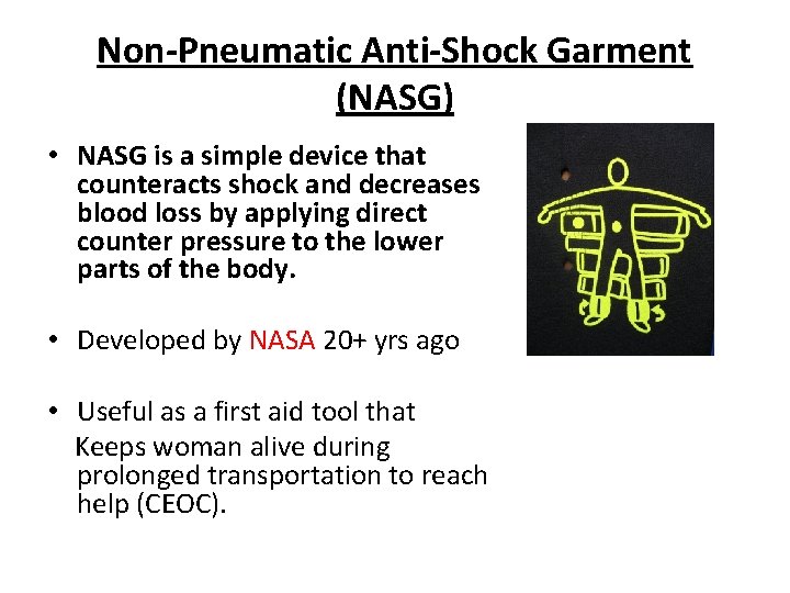 Non-Pneumatic Anti-Shock Garment (NASG) • NASG is a simple device that counteracts shock and