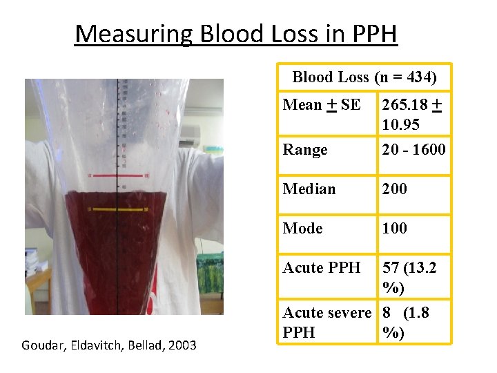 Measuring Blood Loss in PPH Blood Loss (n = 434) Goudar, Eldavitch, Bellad, 2003