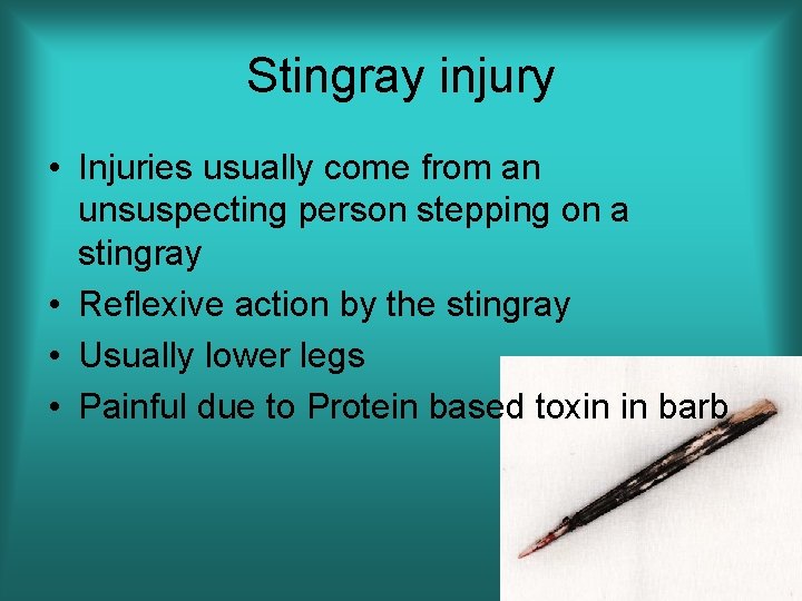 Stingray injury • Injuries usually come from an unsuspecting person stepping on a stingray
