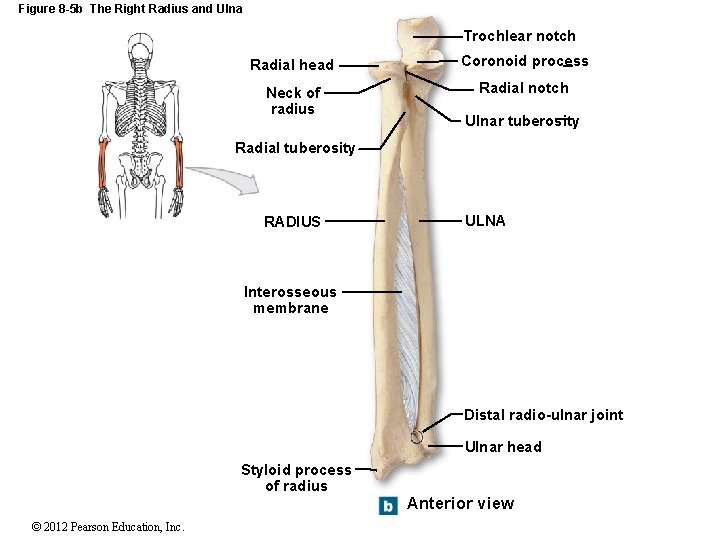 Figure 8 -5 b The Right Radius and Ulna Trochlear notch Radial head Coronoid Figure 8 -5 b The Right Radius and Ulna Trochlear notch Radial head Coronoid