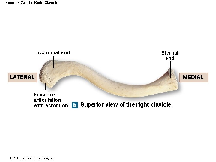 Figure 8 -2 b The Right Clavicle Acromial end Sternal end LATERAL Facet for