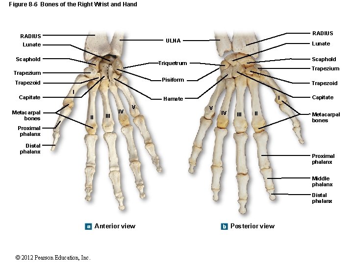 Figure 8 -6 Bones of the Right Wrist and Hand RADIUS ULNA Lunate Scaphold