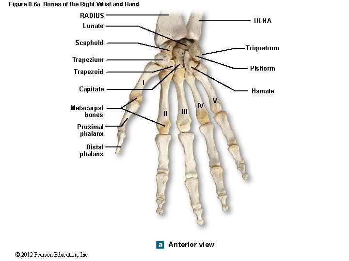 Figure 8 -6 a Bones of the Right Wrist and Hand RADIUS ULNA Lunate