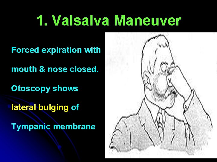 1. Valsalva Maneuver Forced expiration with mouth & nose closed. Otoscopy shows lateral bulging 1. Valsalva Maneuver Forced expiration with mouth & nose closed. Otoscopy shows lateral bulging