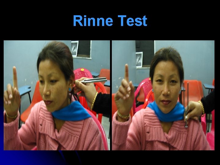 Rinne Test Rinne Test