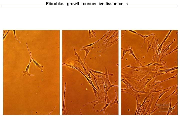 Fibroblast growth: connective tissue cells 