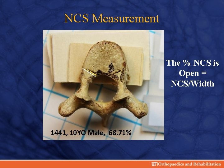 NCS Measurement The % NCS is Open = NCS/Width 1441, 10 YO Male, 68.