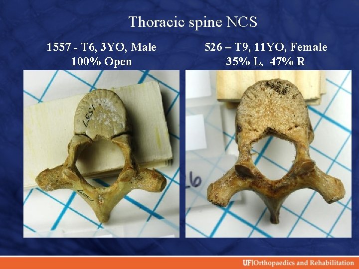 Thoracic spine NCS 1557 - T 6, 3 YO, Male 100% Open 526 –