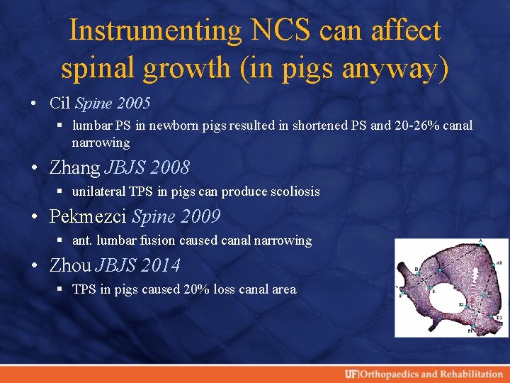 Instrumenting NCS can affect spinal growth (in pigs anyway) • Cil Spine 2005 §