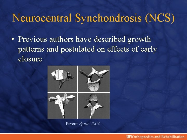 Neurocentral Synchondrosis (NCS) • Previous authors have described growth patterns and postulated on effects