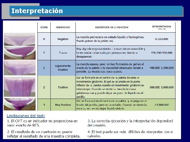 Interpretación 
