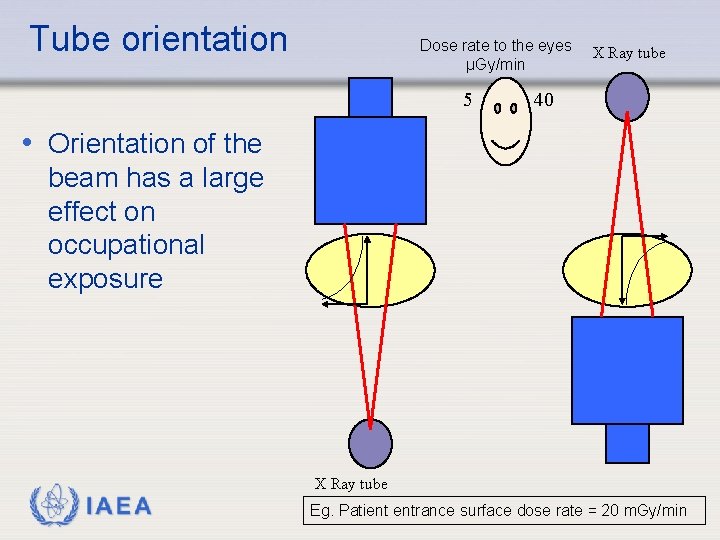 Tube orientation Dose rate to the eyes μGy/min 5 X Ray tube 40 •