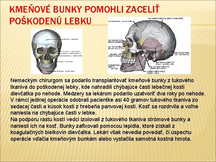 KMEŇOVÉ BUNKY POMOHLI ZACELIŤ POŠKODENÚ LEBKU Nemeckým chirurgom sa podarilo transplantovať kmeňové bunky z