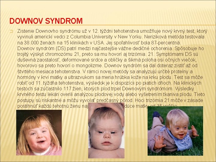 DOWNOV SYNDROM � Zistenie Downovho syndrómu už v 12. týždni tehotenstva umožňuje nový krvný