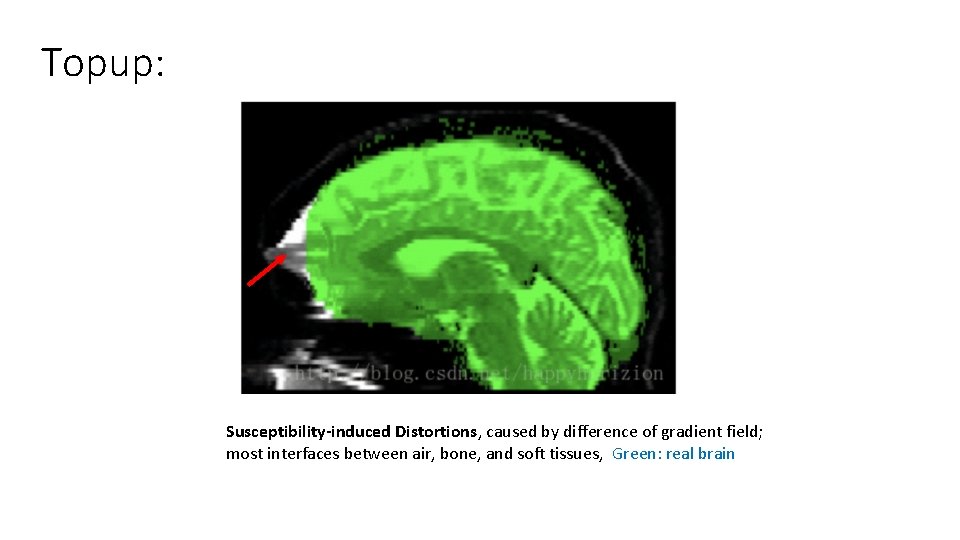 Topup: Susceptibility-induced Distortions, caused by difference of gradient field; most interfaces between air, bone, Topup: Susceptibility-induced Distortions, caused by difference of gradient field; most interfaces between air, bone,