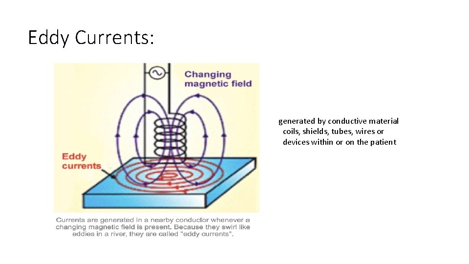 Eddy Currents: generated by conductive material coils, shields, tubes, wires or devices within or Eddy Currents: generated by conductive material coils, shields, tubes, wires or devices within or
