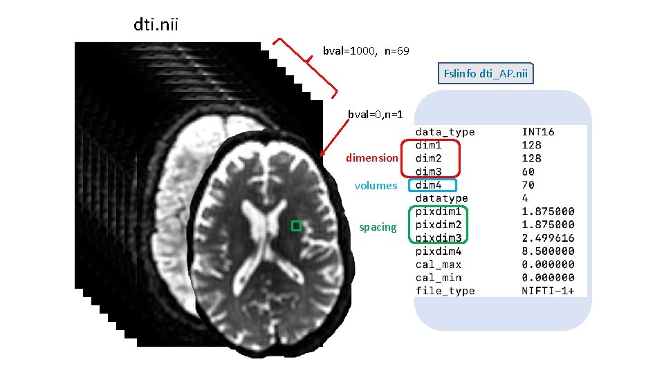 dti. nii bval=1000, n=69 Fslinfo dti_AP. nii bval=0, n=1 dimension volumes spacing dti. nii bval=1000, n=69 Fslinfo dti_AP. nii bval=0, n=1 dimension volumes spacing