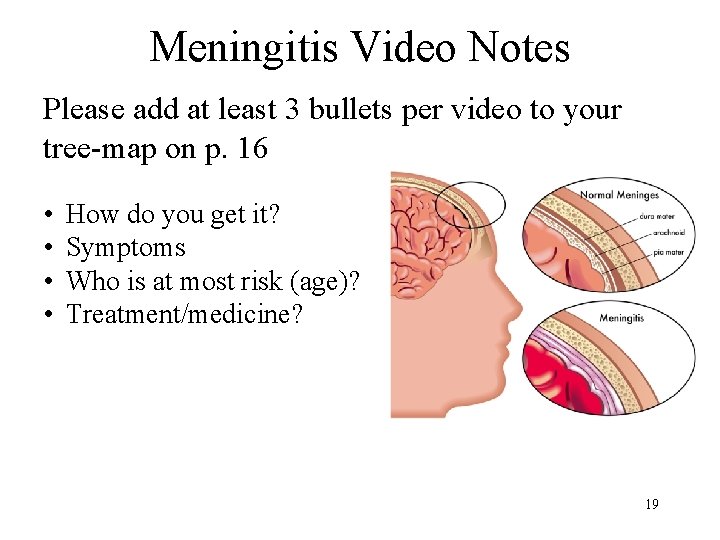 Meningitis Video Notes Please add at least 3 bullets per video to your tree-map