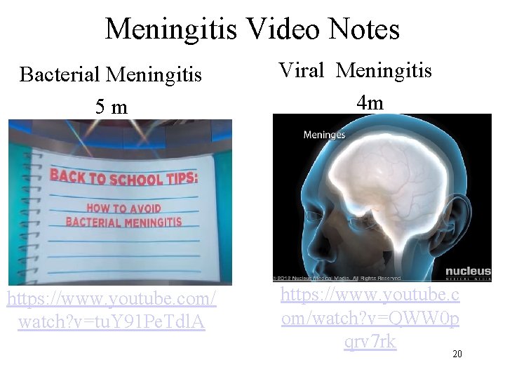 Meningitis Video Notes Bacterial Meningitis 5 m https: //www. youtube. com/ watch? v=tu. Y