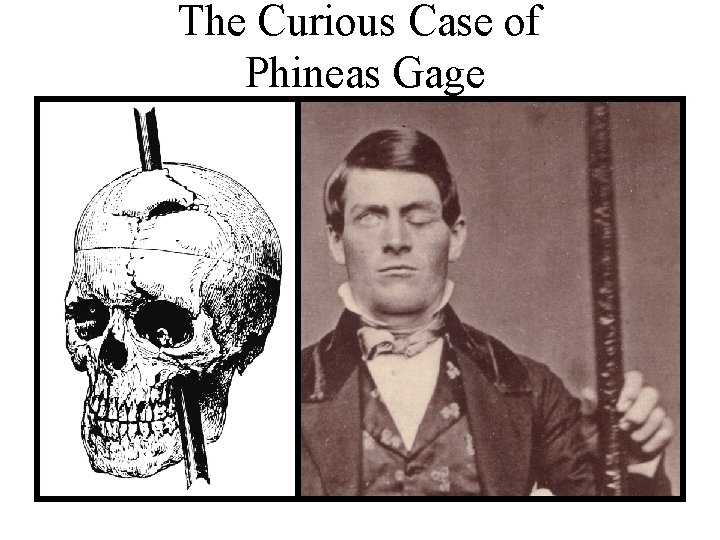 The Curious Case of Phineas Gage 
