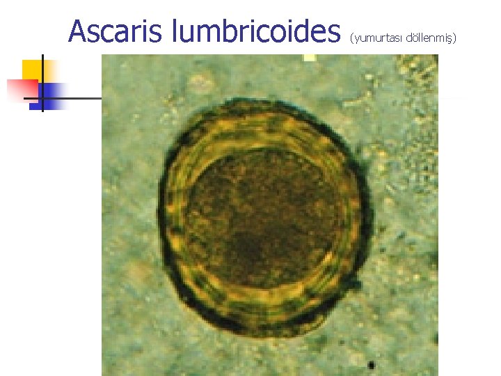 Ascaris lumbricoides (yumurtası döllenmiş) Ascaris lumbricoides (yumurtası döllenmiş)
