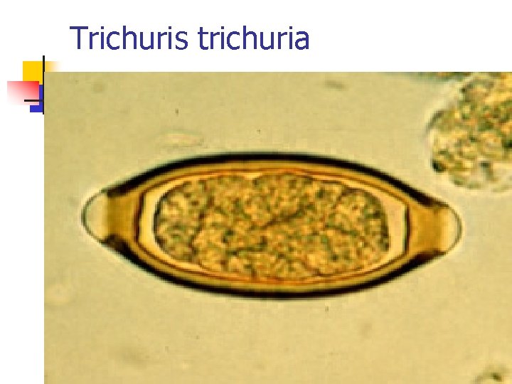 Trichuris trichuria Trichuris trichuria