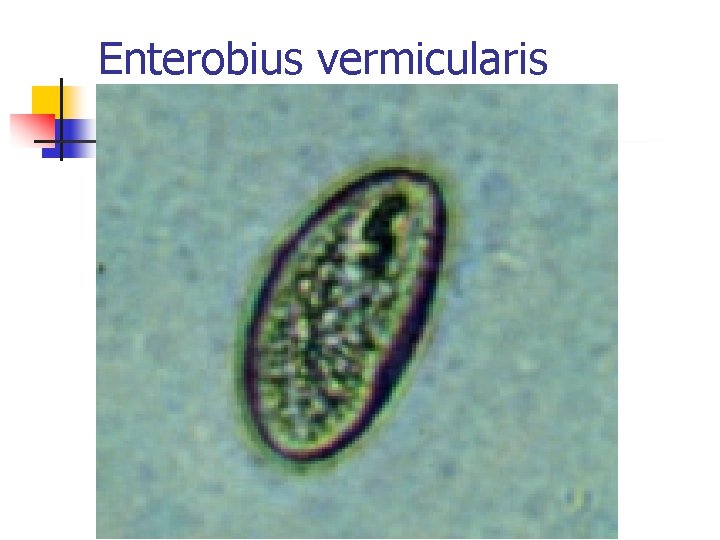 Enterobius vermicularis Enterobius vermicularis