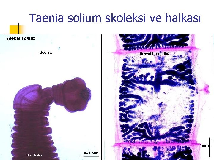 Taenia solium skoleksi ve halkası Taenia solium skoleksi ve halkası