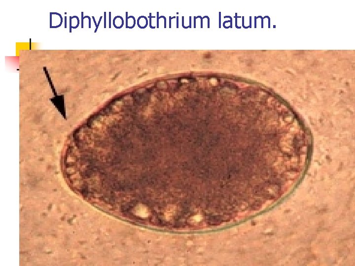 Diphyllobothrium latum. Diphyllobothrium latum.