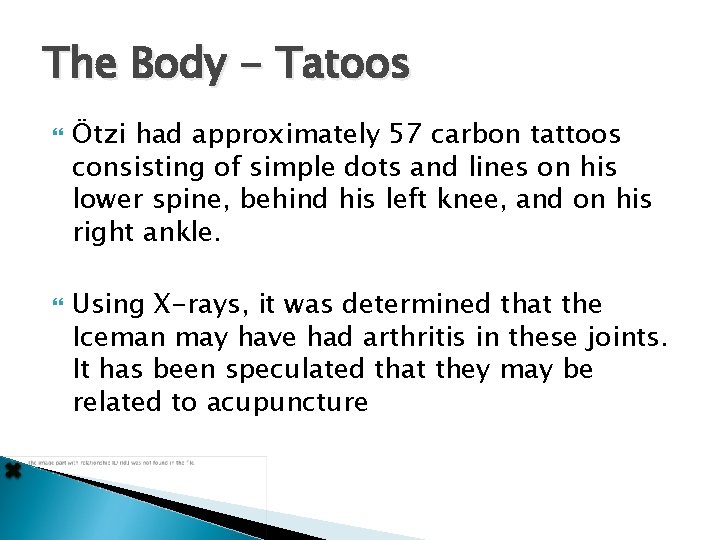 The Body - Tatoos Ötzi had approximately 57 carbon tattoos consisting of simple dots