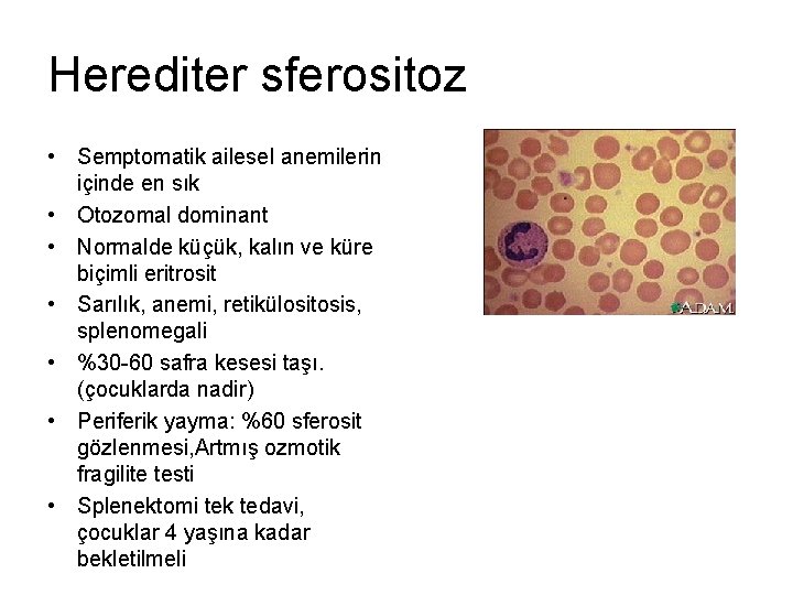 Herediter sferositoz • Semptomatik ailesel anemilerin içinde en sık • Otozomal dominant • Normalde