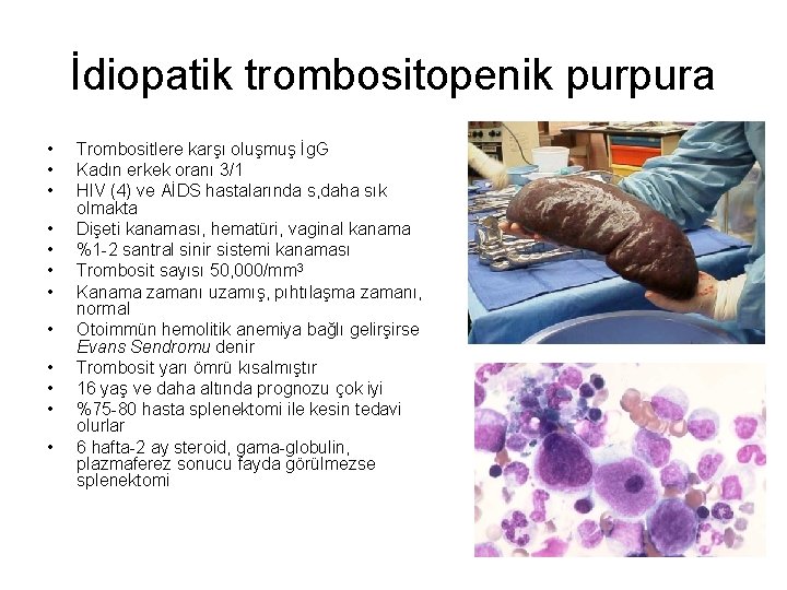 İdiopatik trombositopenik purpura • • • Trombositlere karşı oluşmuş İg. G Kadın erkek oranı