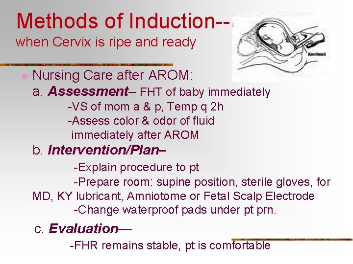 Methods of Induction-when Cervix is ripe and ready n Nursing Care after AROM: a.