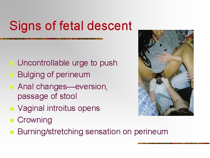 Signs of fetal descent n n n Uncontrollable urge to push Bulging of perineum