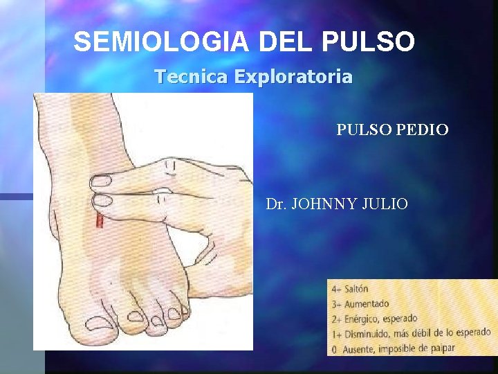 SEMIOLOGIA DEL PULSO Tecnica Exploratoria PULSO PEDIO Dr. JOHNNY JULIO 