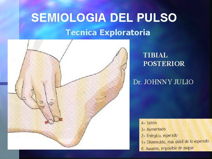 SEMIOLOGIA DEL PULSO Tecnica Exploratoria TIBIAL POSTERIOR Dr. JOHNNY JULIO 