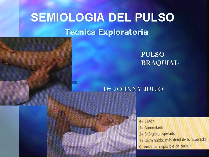 SEMIOLOGIA DEL PULSO Tecnica Exploratoria PULSO BRAQUIAL Dr. JOHNNY JULIO 