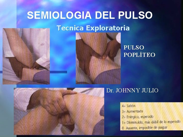 SEMIOLOGIA DEL PULSO Tecnica Exploratoria PULSO POPLÍTEO Dr. JOHNNY JULIO 