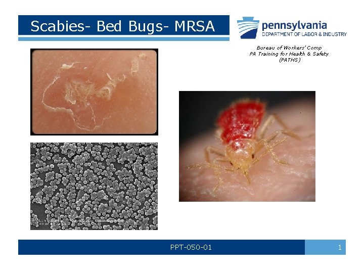 Scabies- Bed Bugs- MRSA Bureau of Workers’ Comp PA Training for Health & Safety