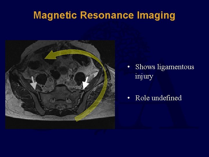 Magnetic Resonance Imaging • Shows ligamentous injury • Role undefined 