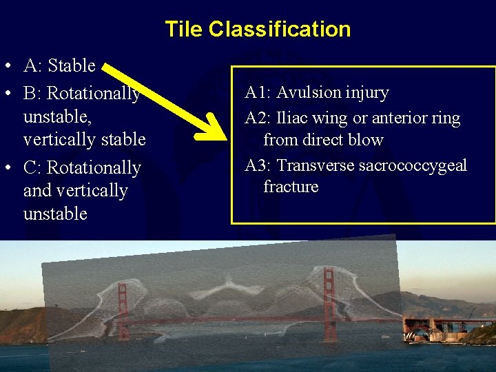 Tile Classification • A: Stable • B: Rotationally unstable, vertically stable • C: Rotationally