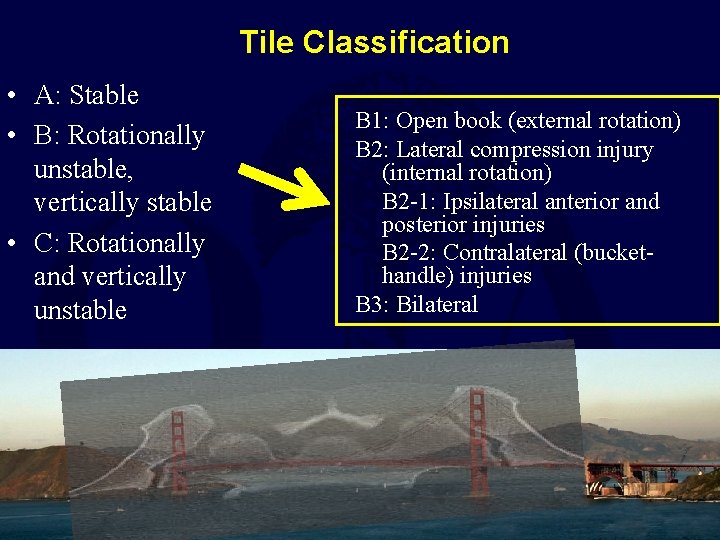 Tile Classification • A: Stable • B: Rotationally unstable, vertically stable • C: Rotationally