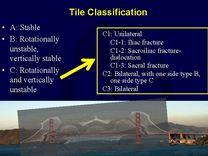 Tile Classification • A: Stable • B: Rotationally unstable, vertically stable • C: Rotationally