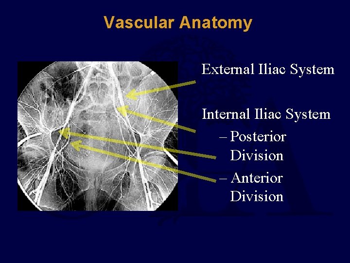 Vascular Anatomy External Iliac System Internal Iliac System – Posterior Division – Anterior Division