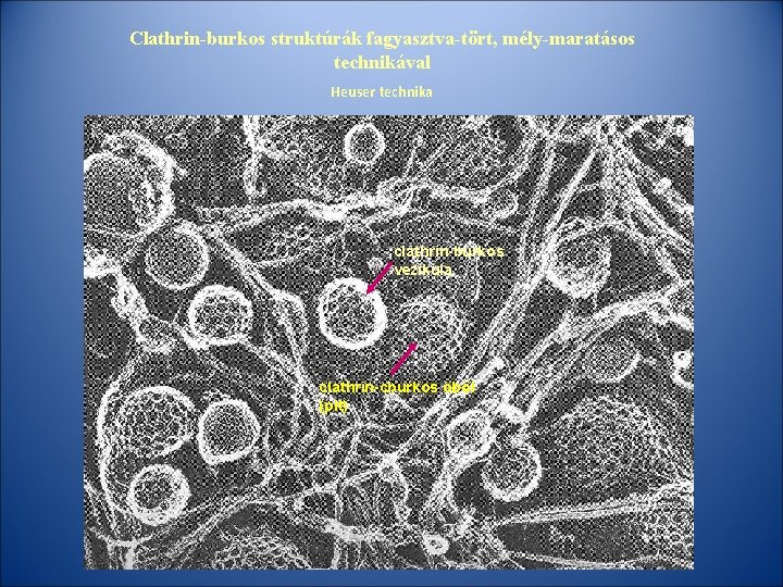 Clathrin-burkos struktúrák fagyasztva-tört, mély-maratásos technikával Heuser technika clathrin-burkos vezikula clathrin-cburkos öböl (pit) 