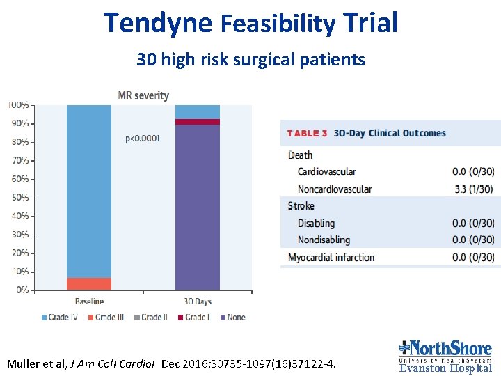 Tendyne Feasibility Trial 30 high risk surgical patients Muller et al, J Am Coll Tendyne Feasibility Trial 30 high risk surgical patients Muller et al, J Am Coll