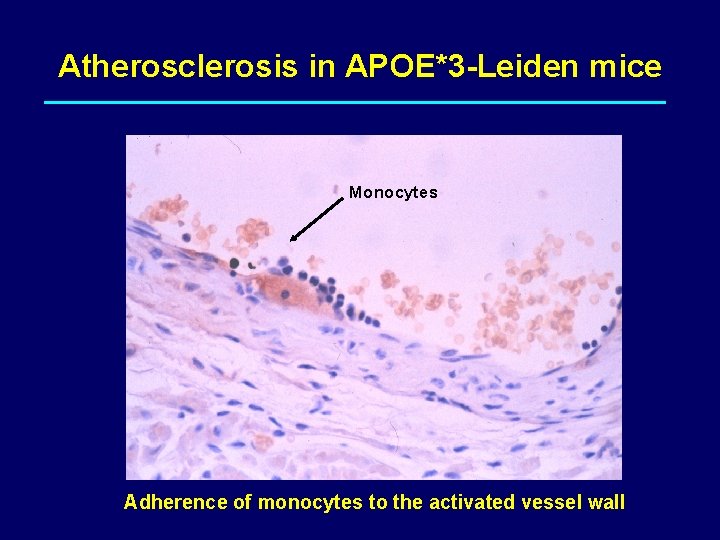 Atherosclerosis in APOE*3 -Leiden mice Monocytes Adherence of monocytes to the activated vessel wall